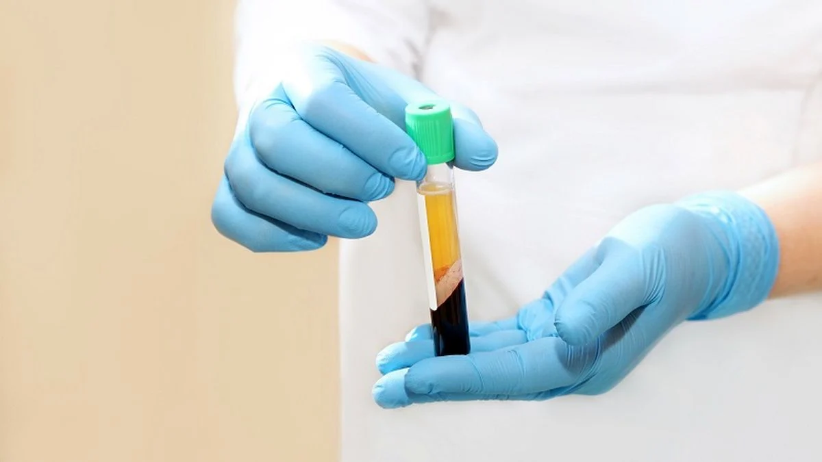 مقایسه PRP با درمانهای دارویی دیگر؛ کدام روش بهتر است؟ مقایسه PRP با درمانهای دارویی دیگر؛ کدام روش بهتر است؟