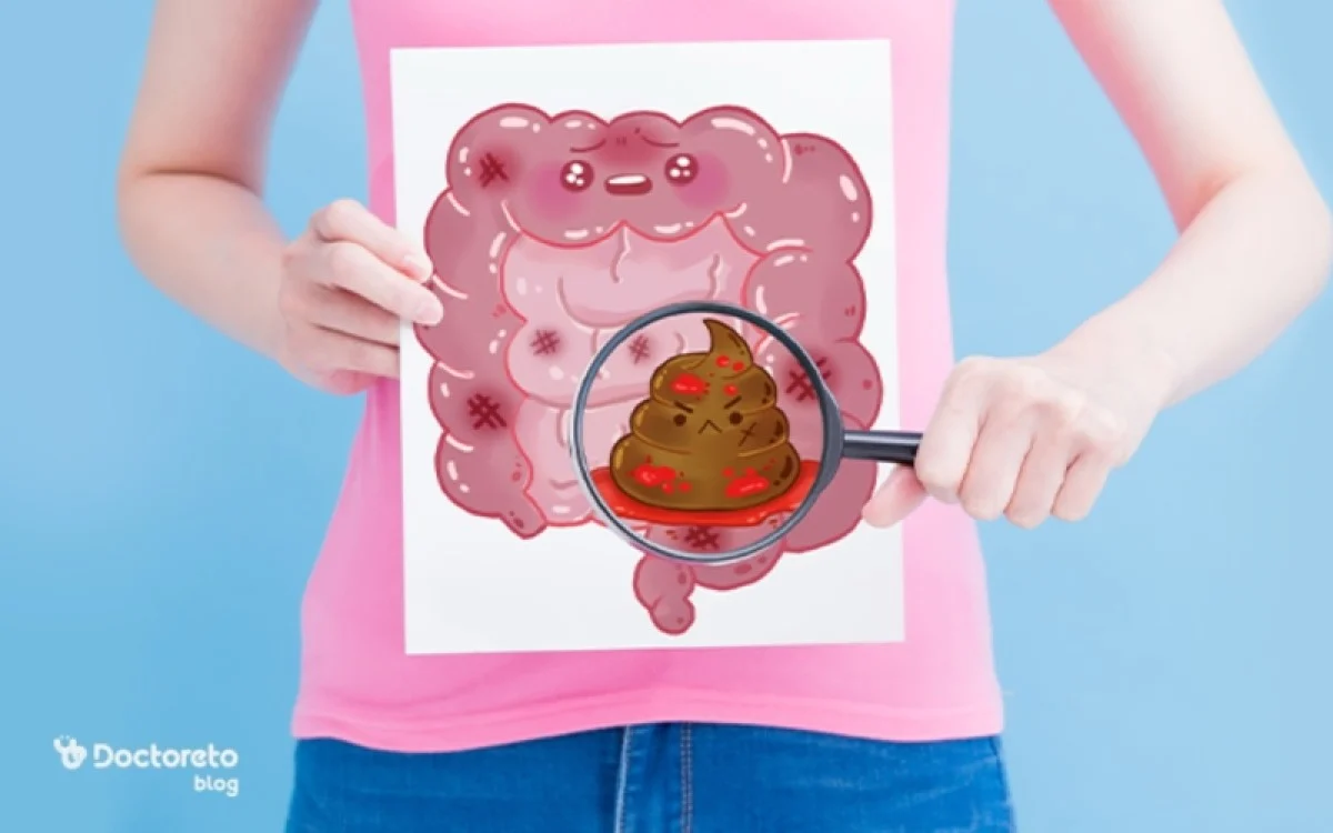 خون در مدفوع؛ چه زمانی باید نگران شویم؟